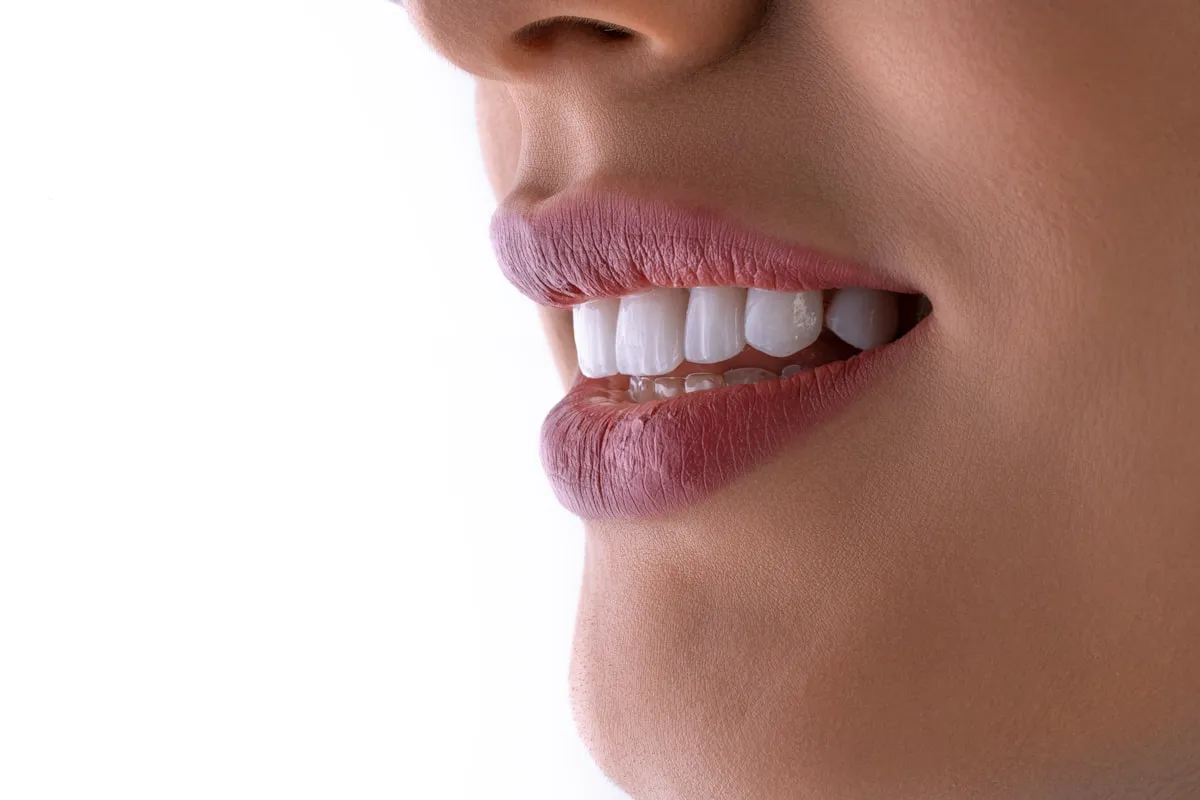 Close-up of a confident, even smile